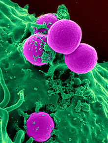 Human_neutrophil_ingesting_MRSA