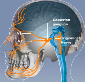 We Heal Trigeminal neuralgia